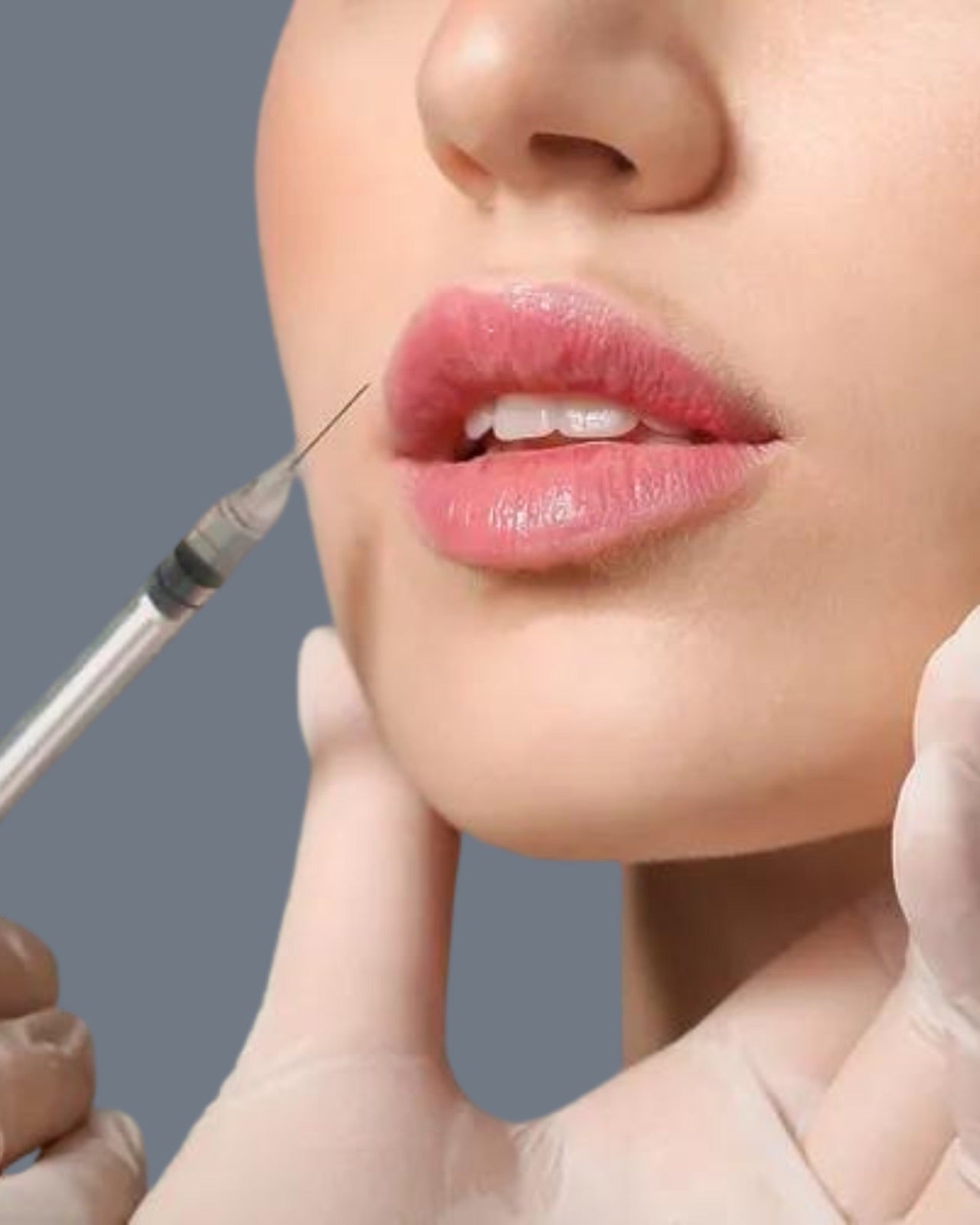 Dermal fillers